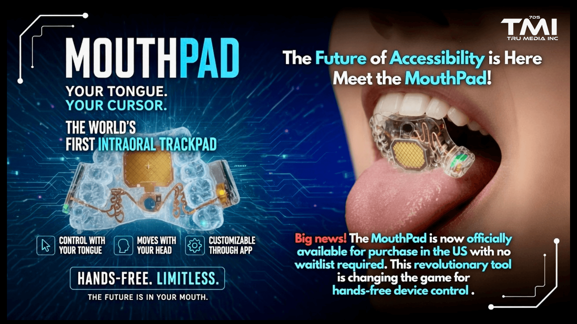 Mouthpad